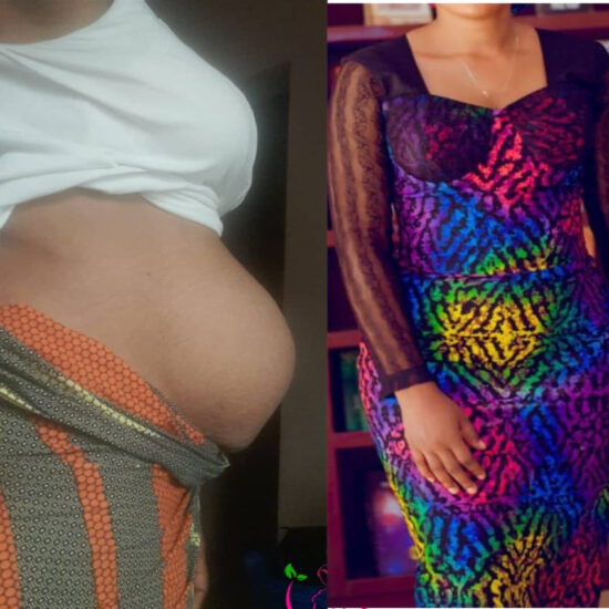 tummyrepair-before-and-after-postpartum-recovery-transformations (7)
